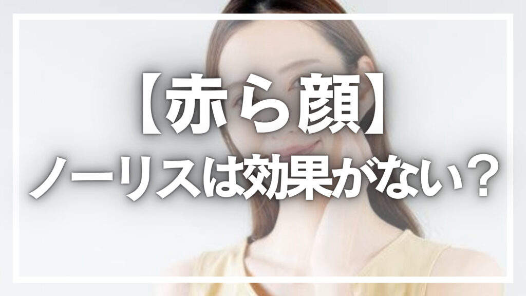 【赤ら顔】ノーリスは効果がない？本当の効果や特徴を解説！