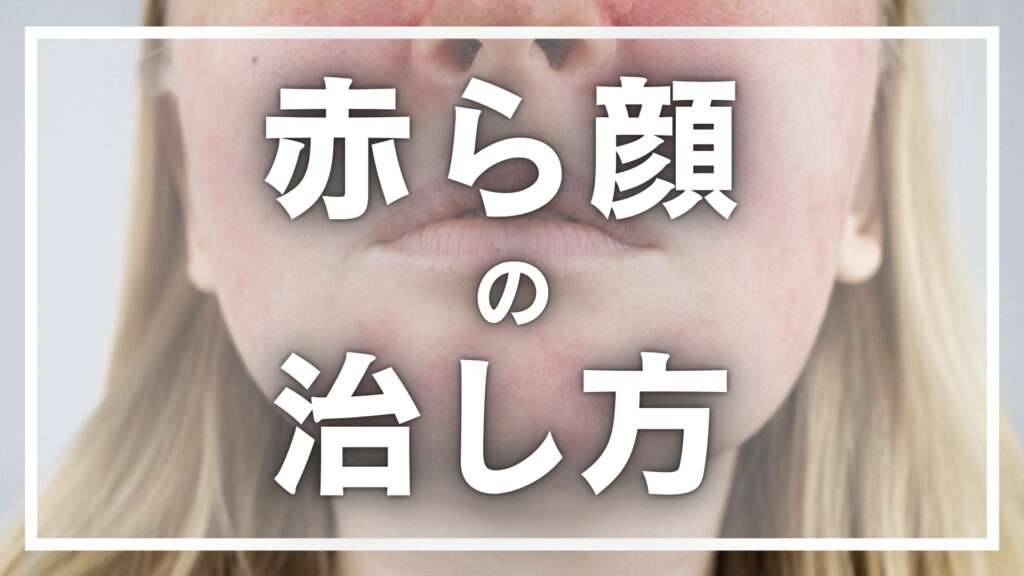 赤ら顔の治し方とは？原因や自分でできる対策など解説！
