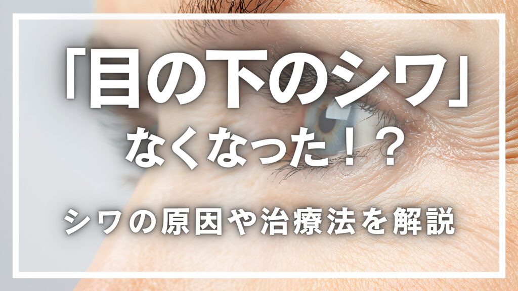 「目の下のシワ」がなくなった！？目元のシワの原因や治療法を解説！