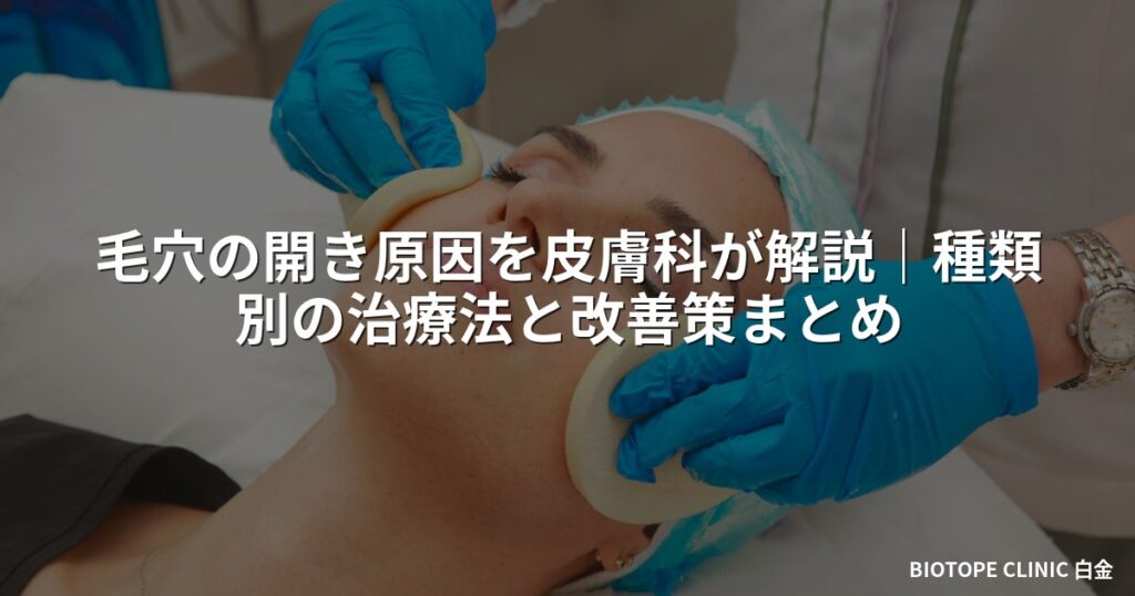 毛穴の開き原因を医師が解説｜種類別の治療法と改善策まとめ
