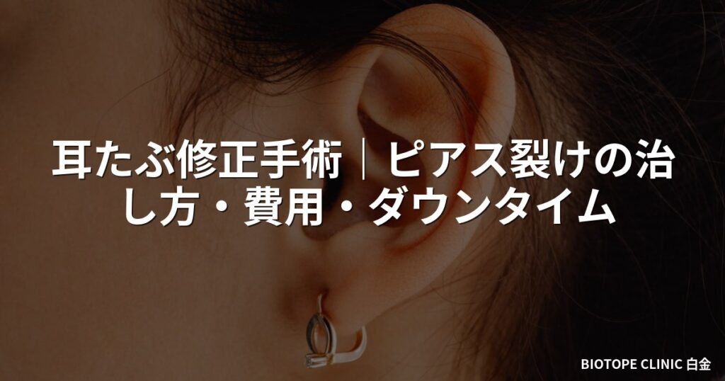 耳たぶ修正手術｜ピアス裂けの治し方・費用・ダウンタイム